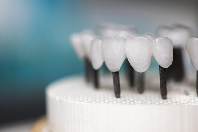 Zirconia Dental Prosthesis Sintering